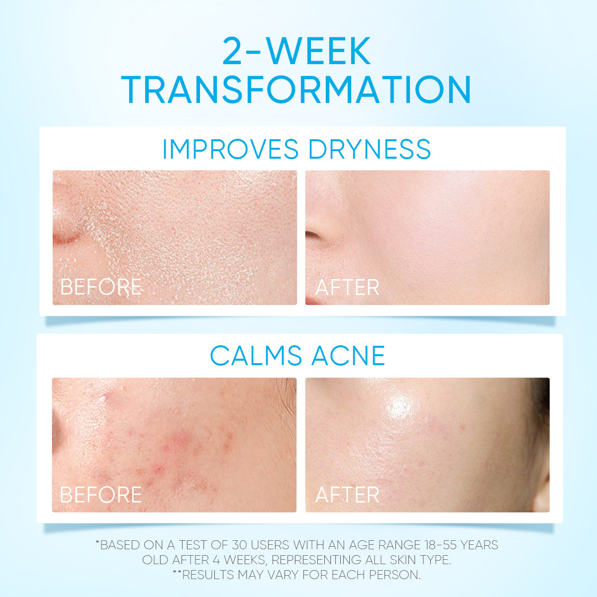 【TOP&HOT】SKINTIFIC OFFICIAL 5X Ceramide Skin Barrier Repair Moisture Gel Moisturizer Cream Face Moisturiser Day Cream