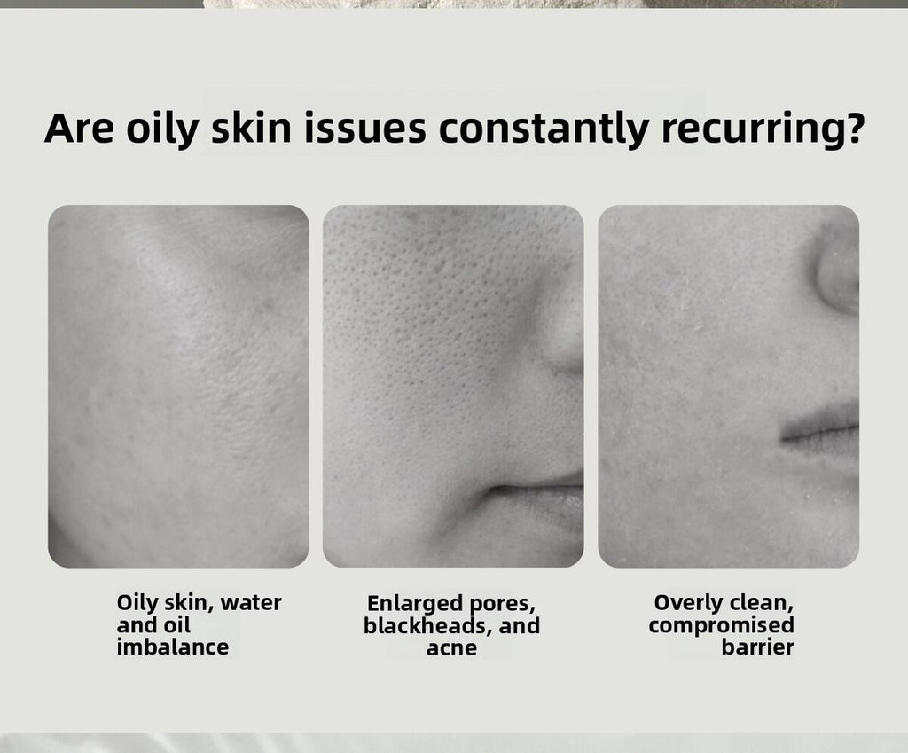 OSITREE | Oil Control Refreshing Cleansing Face Wash with Amino Acids and Salicylic Acid