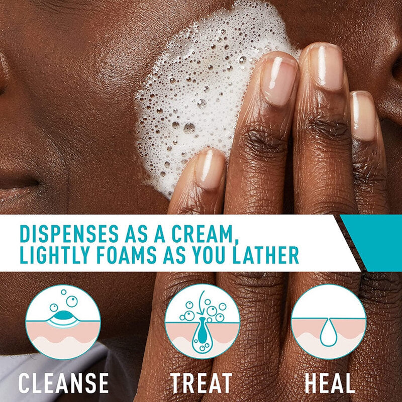 Cerave Acne Control 2% Salicylic Acid Acne Treatment Cleanser 237ml