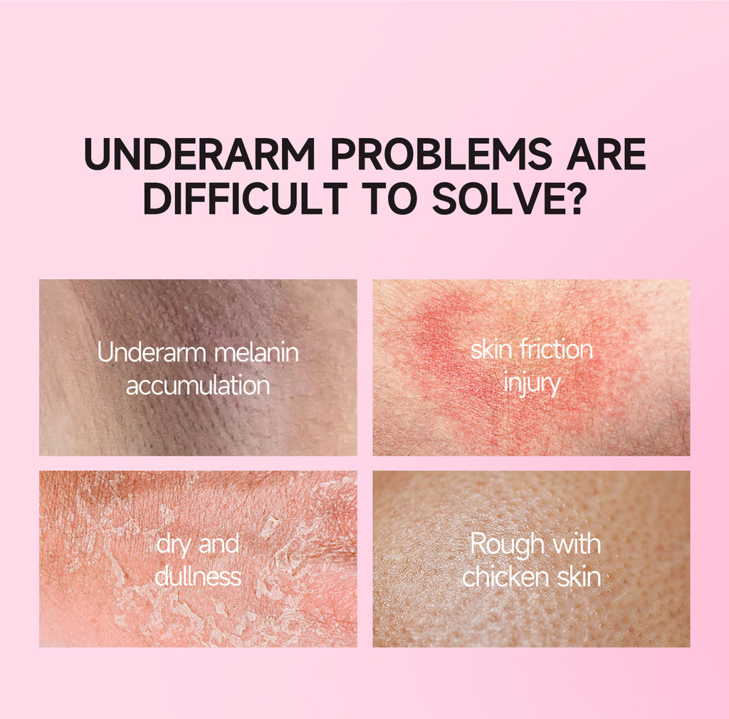 GMEELAN Sakura Underarm Whitening Cream Glutathione 30g 5X Ceramide Body Lotion Pearl Moisturizer